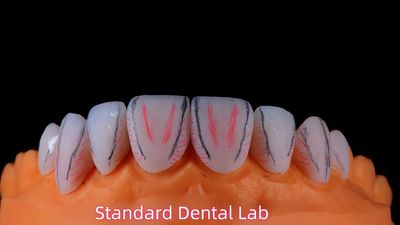 Standard Dental Lab Co., Limited manufacturer production line