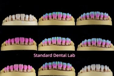 Standard Dental Lab Co., Limited manufacturer production line