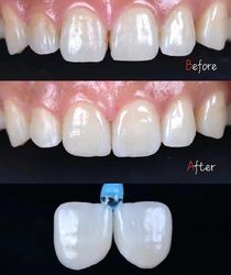 Standard Dental Lab Co., Limited manufacturer production line