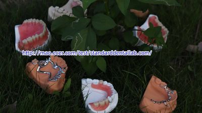 Standard Dental Lab Co., Limited manufacturer production line