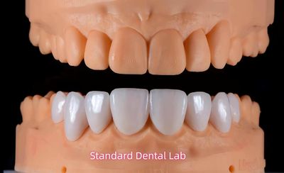 Standard Dental Lab Co., Limited manufacturer production line