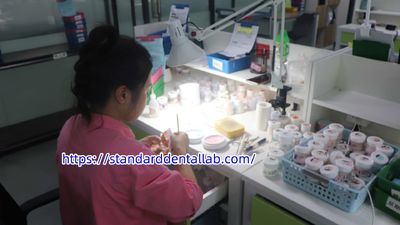 Standard Dental Lab Co., Limited manufacturer production line