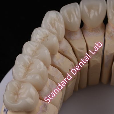 Buy Digital CAD CAM Dental Lab PFZ Crowns Translucent Layered Zirconia Crown online manufacture