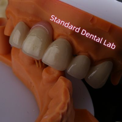 Buy Highly Biocompatible PFZ Porcelain Layered Zirconia With Pink Gum online manufacture