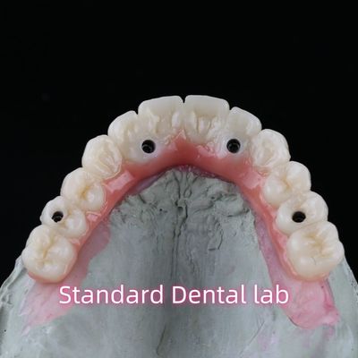 Buy Porcelain Zirconia Dental Implant Bridge Professional High Esthetics With Pink Gum online manufacture
