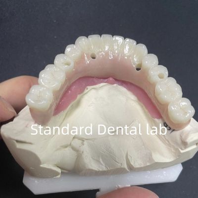 Buy Esthetic Restoration All On 4 Dental Implants Zirconia Hypo Allergenic online manufacture