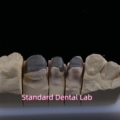Buy Metal Cast Post Core Crown Cocr Accurate Retentive Full Zirconia Bruxier online manufacture