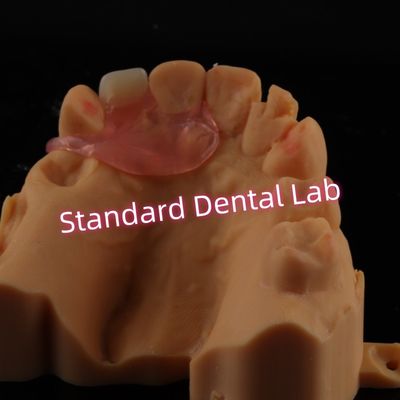 Buy Upper Valplast Unilateral Dentures Removable Flexible One Tooth Partial Teeth online manufacture