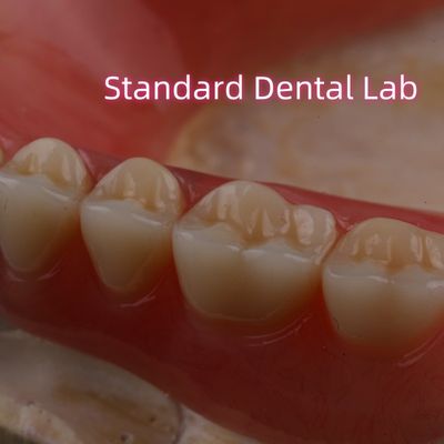 Buy SDL Heat Cured Acrylic Partial Denture Ivoclar Teeth Dental Lab High Accuracy online manufacture