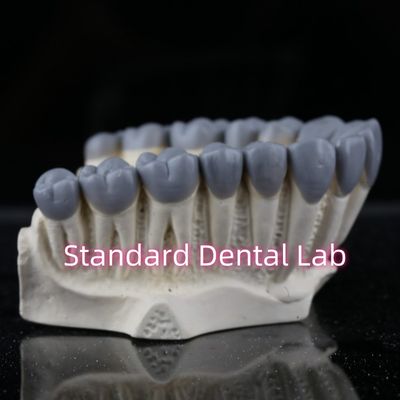 Buy SDL Dental Lab Digital Diagnostic Wax Ups Crown Bridge online manufacture