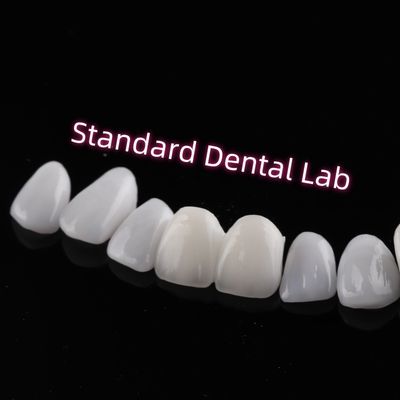 Buy Abrasion Resistant Emax Zirconia Laminate Veneers Incisal Translucency online manufacture