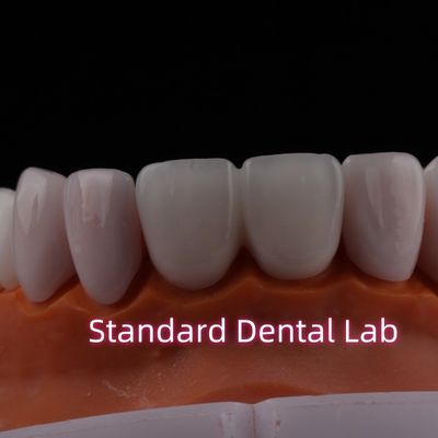 Buy Tranlucent Emax Zirconia Laminate Veneers Porcelain Dental Veneers Chemically Verystable online manufacture