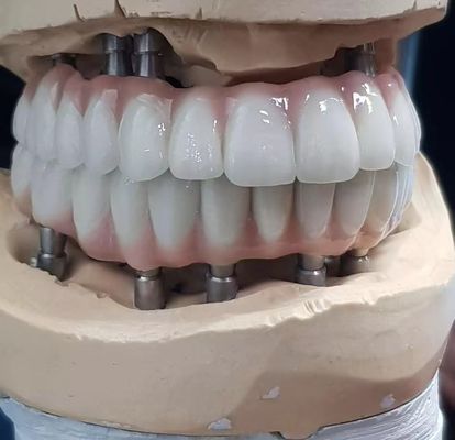 Buy Precision-Crafted Zirconia Implant Screw Cement Retained for Natural-Looking Teeth online manufacture