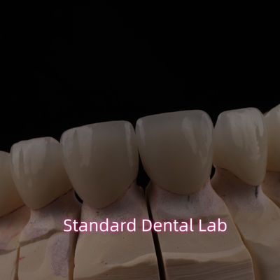 Buy PFZ Dental Layered Ceramic Zirconia Bridge With Incisal Translucent online manufacture
