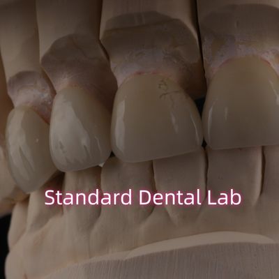 Buy Professional Dental Lab Zirconia Crown For Fixed Restoration online manufacture