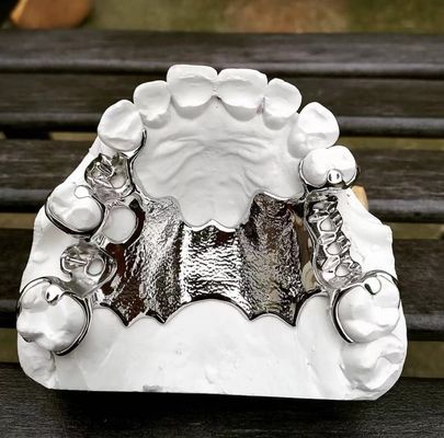Buy Cobalt Chrome Removable Partial Denture Framework Laser Printing Ni Be Free online manufacture