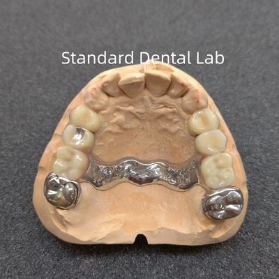Buy Removable Precision Attachment Dental Partial Denture Stable Professional online manufacture