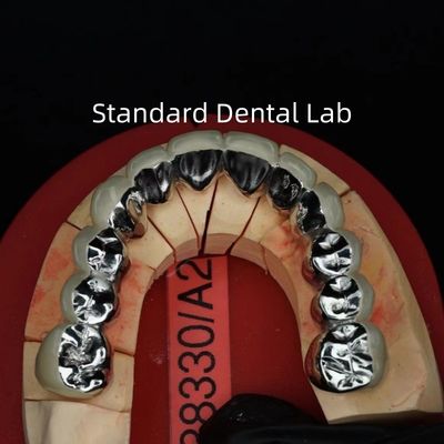 Buy Full Arch Metal Porcelain Crowns / Bridge Precise Esthetic PFM Crown Dental online manufacture