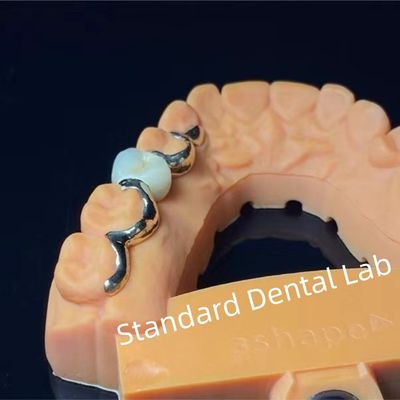 Buy Dental Teeth PFM Maryland Bridge High Esthetics FDA Certified online manufacture