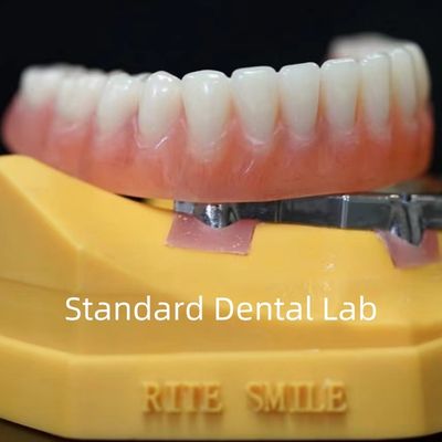 Buy Titanium Implant Supported Dentures Precise Ivoclar Denture Over Implants ISO FDA CE online manufacture