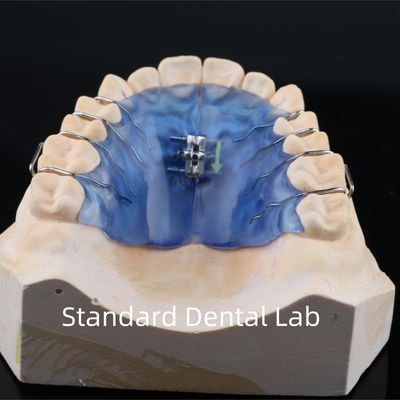Buy Screw Arch Dental Teeth Palate Expander Removable Ortho Screw Expander online manufacture