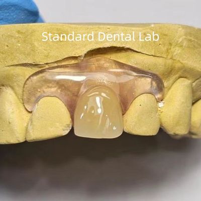 Buy Dental TCS Valplast Flexible Partial Dentures Staining Fading Odors Resistant online manufacture