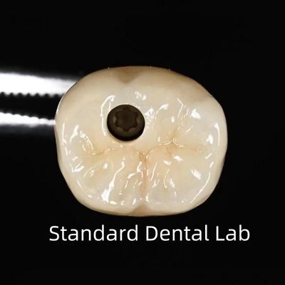 Buy Screw Retained Dental Implant Crown online manufacture