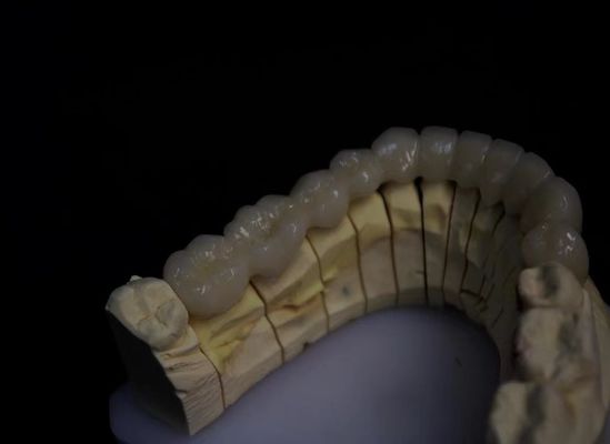 Buy Layered Porcelain Fused Zirconia online manufacture
