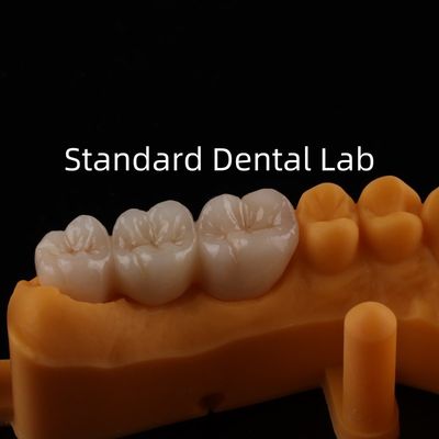 Buy Be Ni Free Metal Porcelain Crowns Precise Esthetic PFM Crown Dental online manufacture
