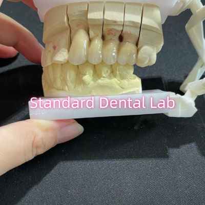 Buy Cast PFM Non Precious CoCr Metal Porcelain Bridge Dental CCM online manufacture