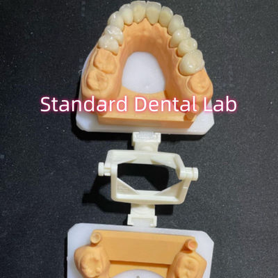 Buy Dental Restorative Dentistry Oral Care Full Zirconia Crown Customized online manufacture
