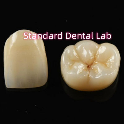 Buy Biocompatible Material Aesthetic Zirconia Crown Zirconia Bridge Teeth online manufacture