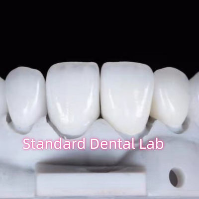 Buy Natural Looking Restorations Aidite Dental Zirconia Tooth Crown online manufacture
