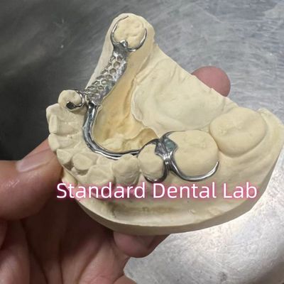 Buy Skelete Chrome Cast Partial Denture Metal Framework ISO online manufacture