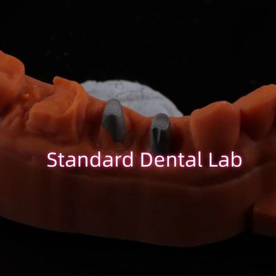 Buy Metal Post Core Crown CAD CAM Porcelain / Zirconia Coping Full Zircnonia Bruxier Crowns online manufacture