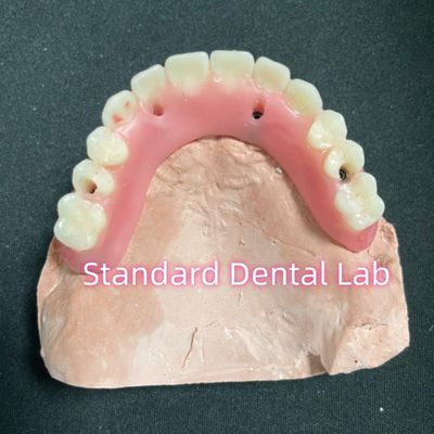 Buy Acrylic Partial Implant Over Denture Titianium Bar Full Denture Teeth Set Up Screw Retained online manufacture