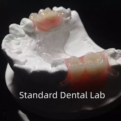 Buy Flexible Clear Metal Cast Framework Partial Dentures High Esthetics Perfect Fit online manufacture