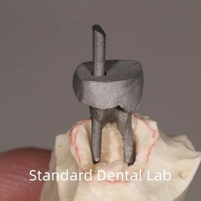 Buy Dental Restoration Metal Post And Core Crown Perfect Fit online manufacture