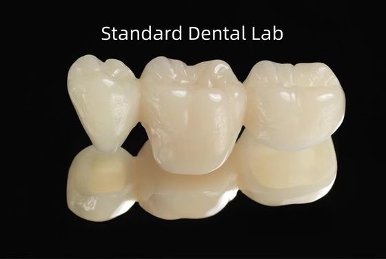 Buy CAD CAM Empty PMMA Provisional Dental Temporary Bridge online manufacture