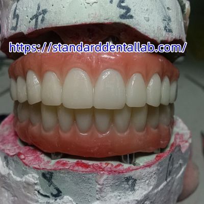 Buy Dental Implant Temporary Crown PMMA Bridge With Pink Porcelian online manufacture