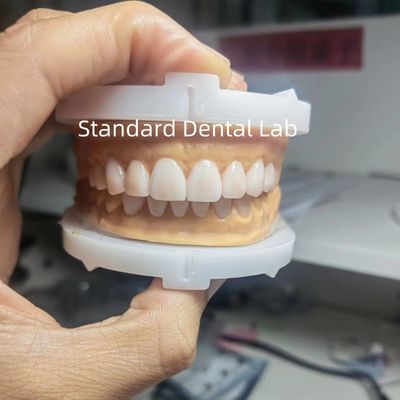 Buy Perfect Esthetics Provisional Wax Up for Dental Professionals using dental wax from China Dental Lab online manufacture