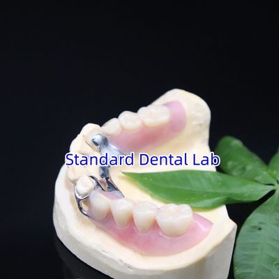 Buy Acrylic Metal Partial Denture Frameworks High Esthetics SDL dental lab online manufacture