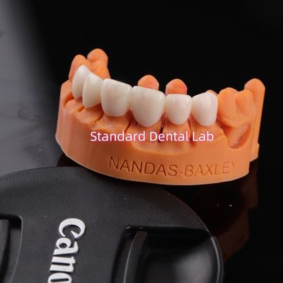 Buy Comfort and Function with Digital CAD CAM Dental Lab Translucent Layered Zirconia Bridge online manufacture