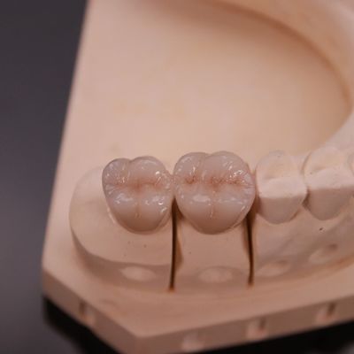 Buy Comfortable Zirconia Crown with Precise Esthetic Finish Express 3-4 Day Turnaround Time online manufacture