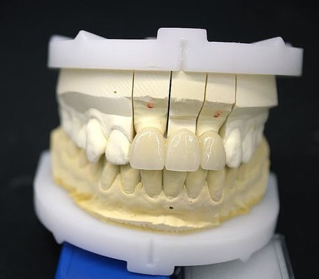 Buy Precise Zirconia Crown Bridge Comfortable Fit / Esthetics 3-4 Days Quick Turnaround Time online manufacture