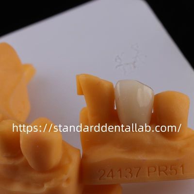 Buy Full Contour Dental Lab Crowns High Translucency Solid Zirconia Crown China Dental Lab online manufacture