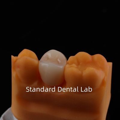Buy Full Contour Zirconia Crown Exceptional Strength and Esthetics No Porcelian Overlay Posterior Crown China Dental Lab online manufacture