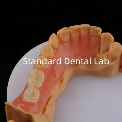 Buy Ace Teeth Pink/Dark TCS Valplast Flexible Partial Dentures for High Esthetics Dental 3D Print Model online manufacture