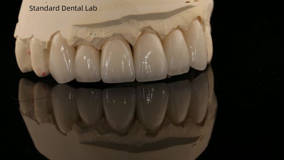 Buy Full Contour Zirconia Crown and High Aesthetic Natural Dental Bridge 5 Year Guarantee online manufacture