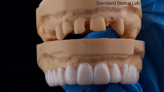 Buy High Esthetics Dental Snap On Smile Standard Dental Lab Removable Dental Appliance online manufacture